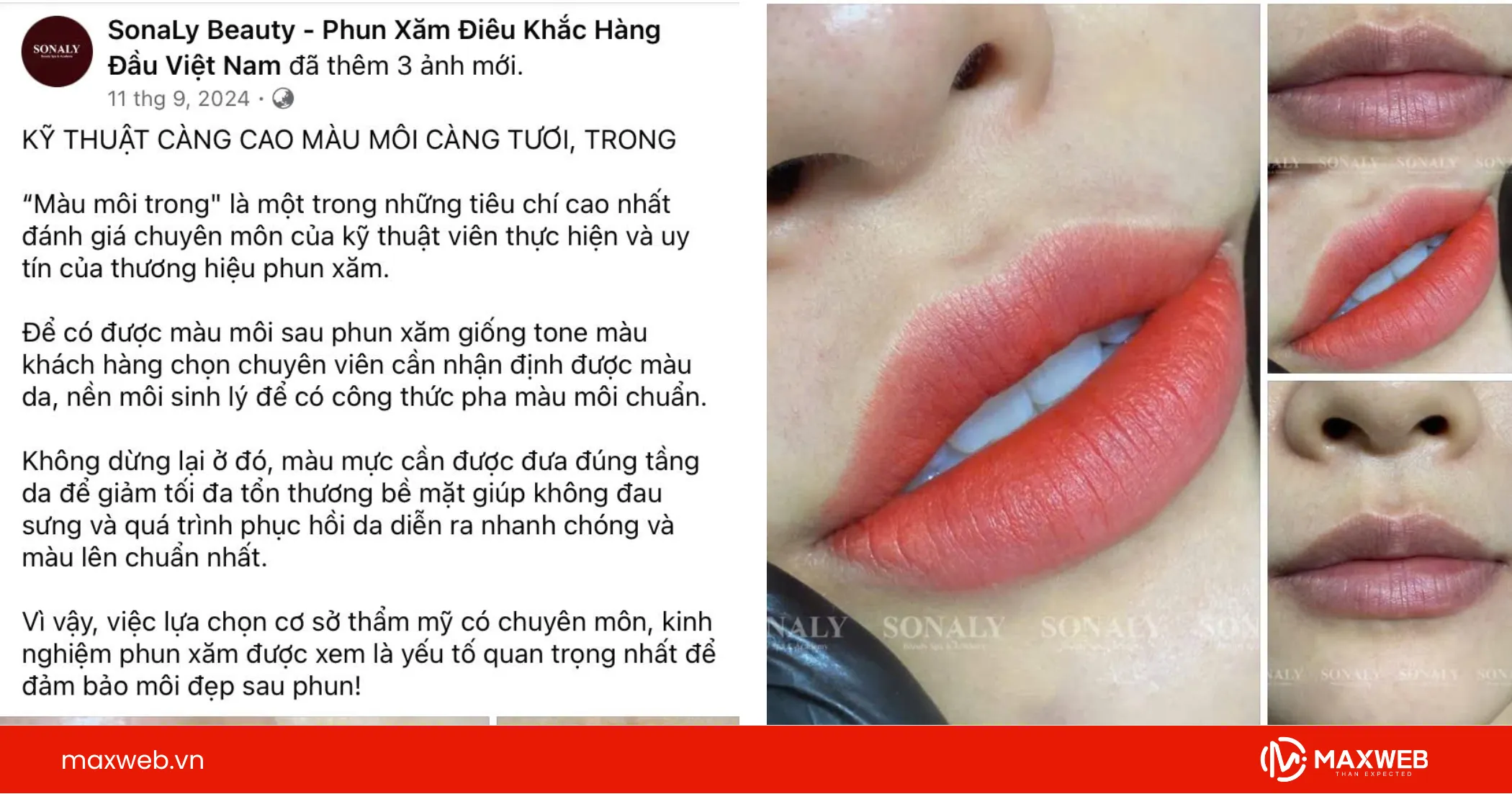 Bài quảng cáo về dịch vụ săm môi