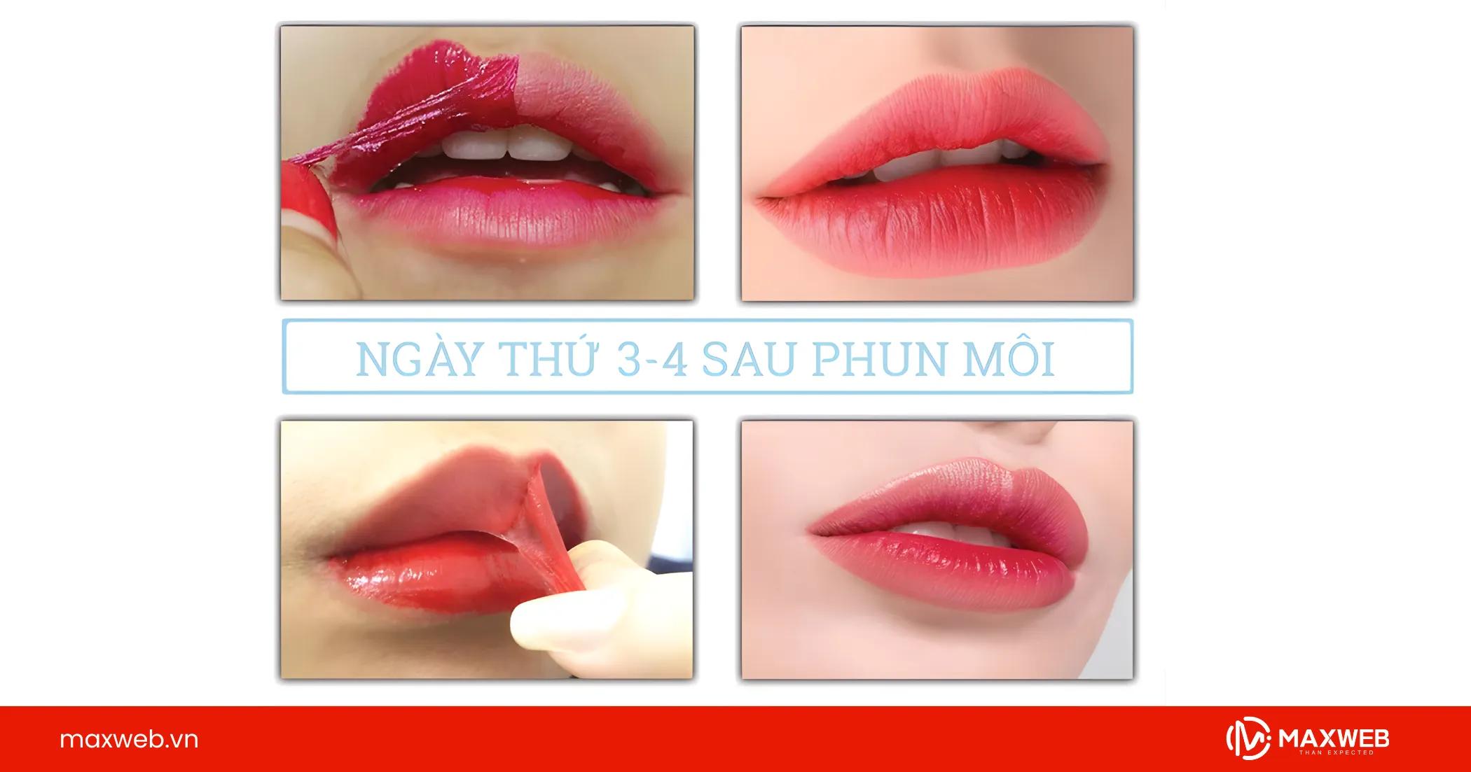 STT phun môi trước và sau khi làm