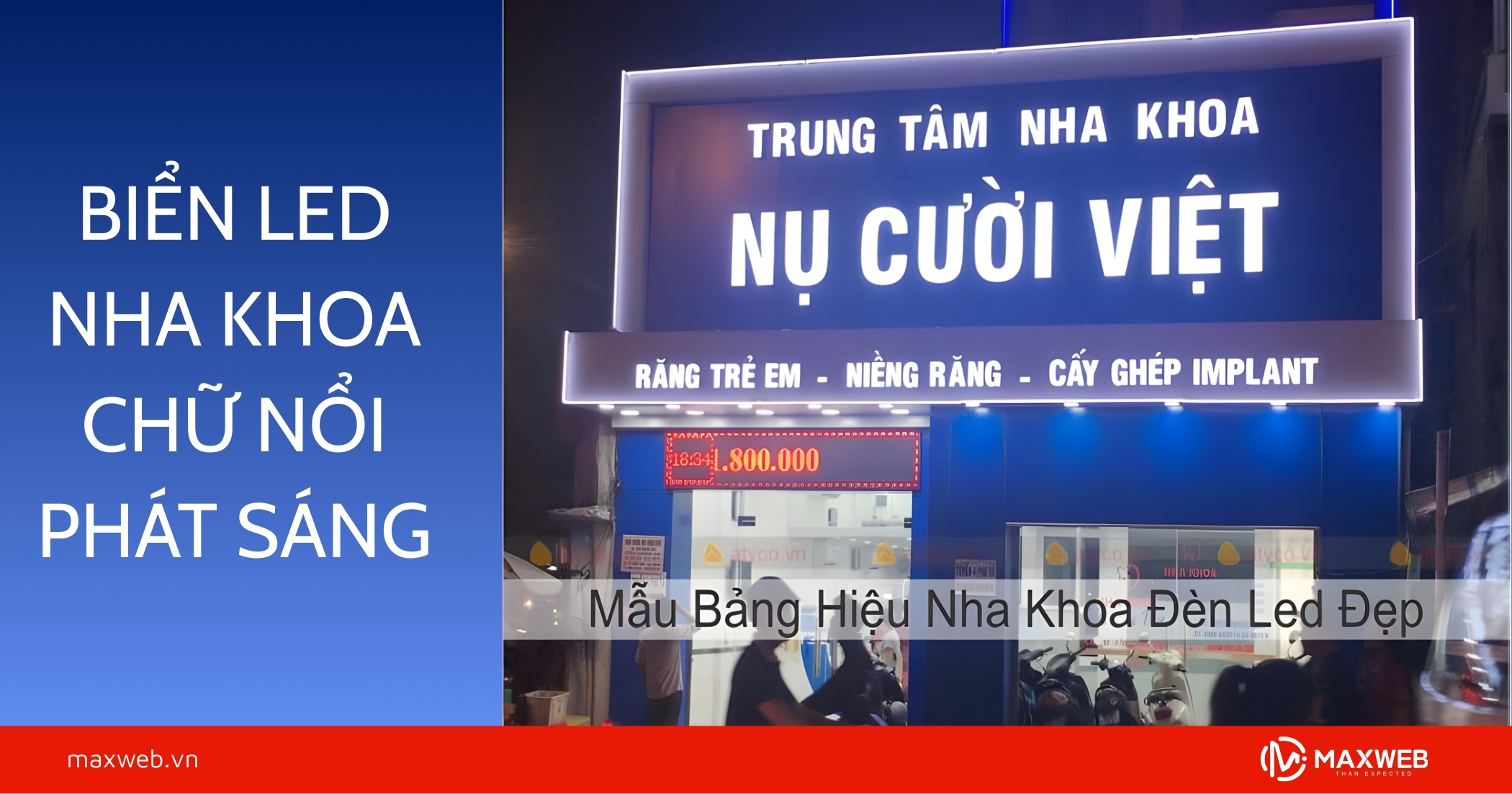 Biển led nha khoa chữ nổi phát sáng